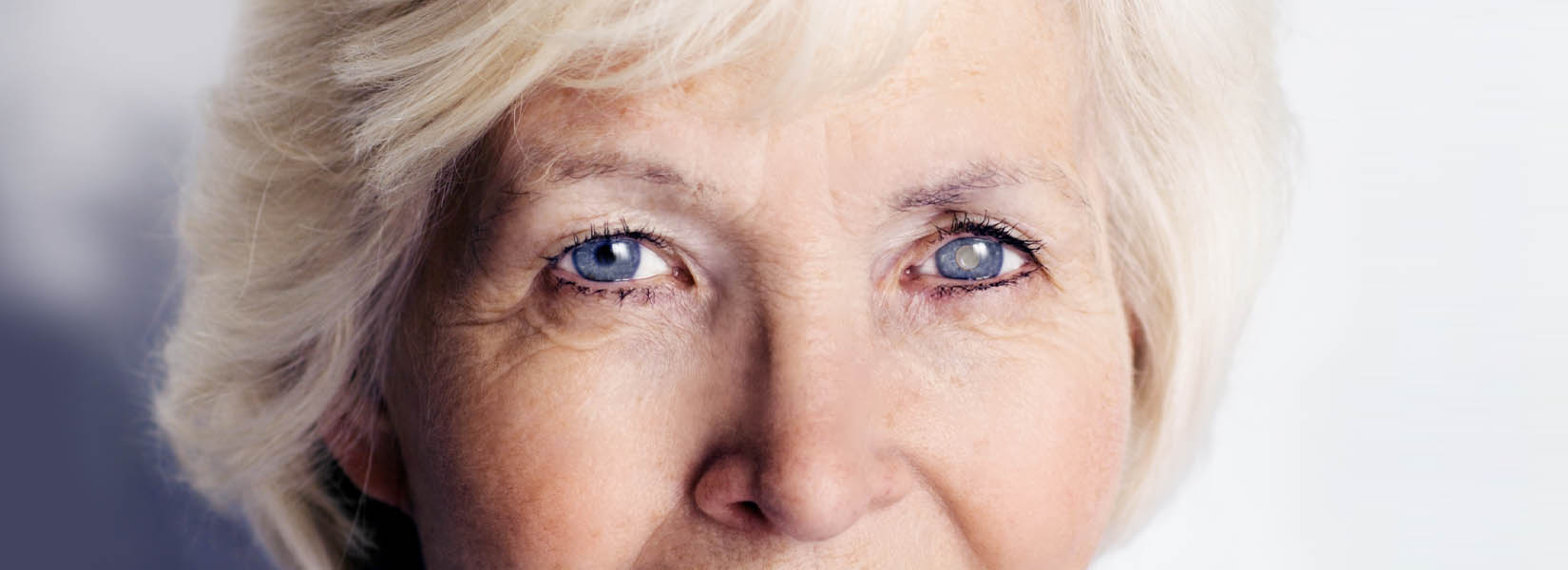 Cataract Surgery in Jefferson City